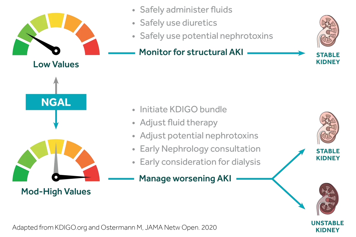 Infographic showing NGAL levels guiding treatment for AKI: low values indicate monitoring and safe fluid/nephrotoxin use, while high values suggest intensive management to prevent worsening AKI.